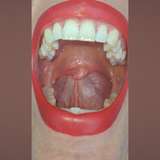 tiny_uvula
